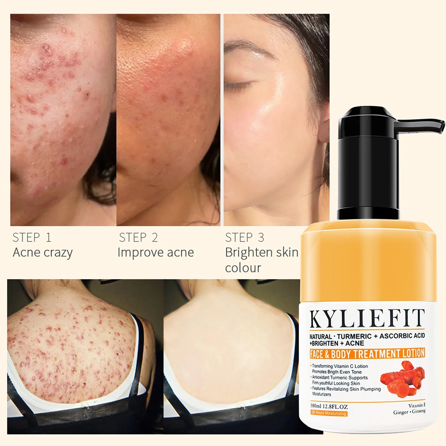 Ailke Anti Aging Firming And Brightening Lotion For Even Skin Tone And Age Spots