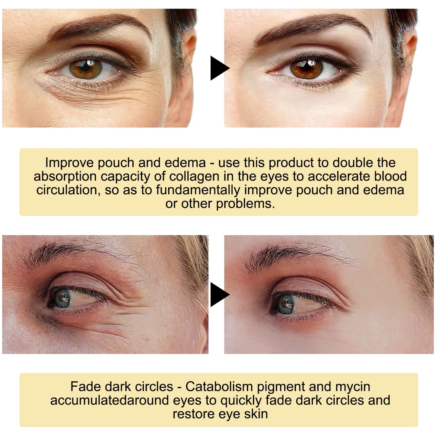 Eelhoe 24K Gold Eye Mask for Dark Circles and Firming