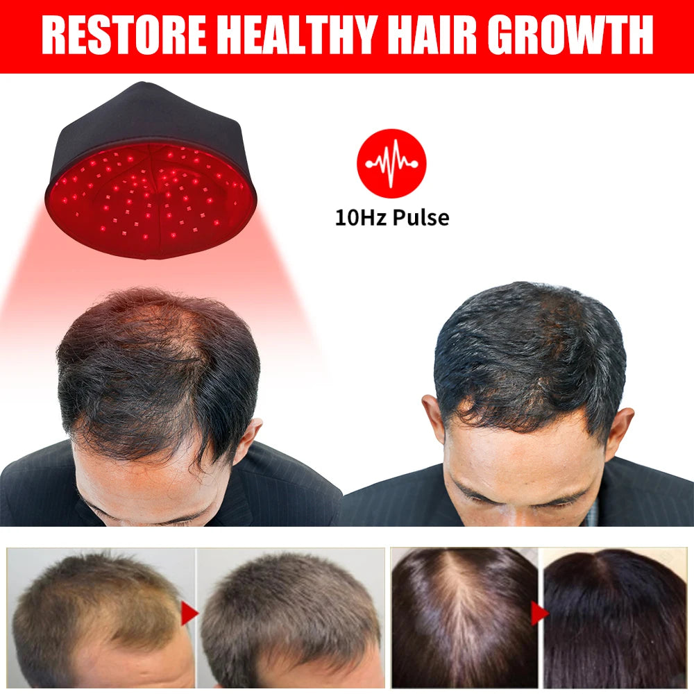 Red Light Regrowth Cap With Infrared LEDs For Scalp Therapy